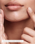 CHIN PATCHES
