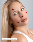HEARTED SPOT PATCHES